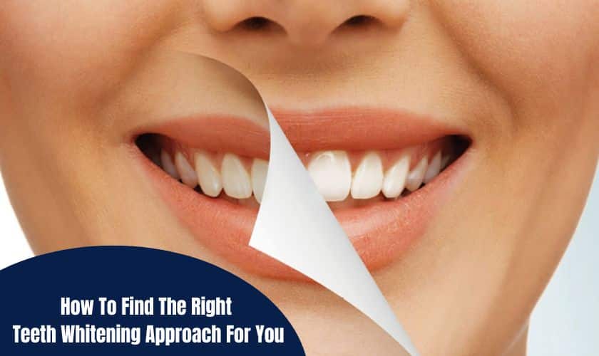 Find The Right Teeth Whitening Approach For You