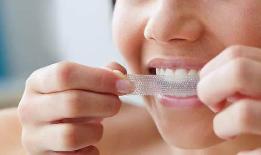 Can You Whiten Veneers With Toothpaste Or Whitening Strips?